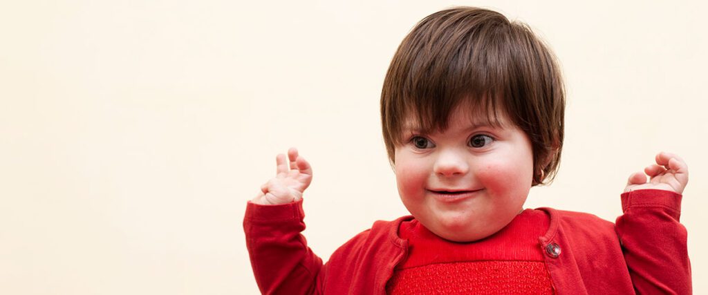 ¿Qué es el Síndrome de Down?